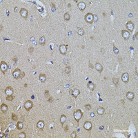Immunohistochemistry of paraffin-embedded Rat brain using ITGB8 Polyclonal Antibody at dilution of 1:100 (40x lens) .