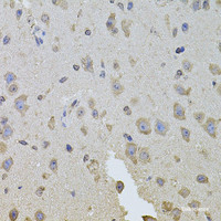 Immunohistochemistry of paraffin-embedded Mouse brain using ITGB8 Polyclonal Antibody at dilution of 1:100 (40x lens) .