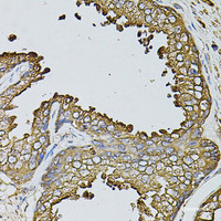 Immunohistochemistry of paraffin-embedded Human prostate using MYL1 Polyclonal Antibody at dilution of 1:100 (40x lens) .