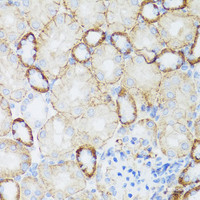 Immunohistochemistry of paraffin-embedded Mouse kidney using NEFH Polyclonal Antibody at dilution of 1:100 (40x lens) .