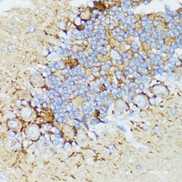 Immunohistochemistry of paraffin-embedded Rat cerebellum using NEFH Polyclonal Antibody at dilution of 1:100 (40x lens) .
