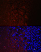 Immunofluorescence analysis of Rat brain using NEFH Polyclonal Antibody at dilution of 1:100. Blue: DAPI for nuclear staining.