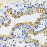 Immunohistochemistry of paraffin-embedded Mouse lung using UVRAG Polyclonal Antibody at dilution of 1:100 (40x lens) .