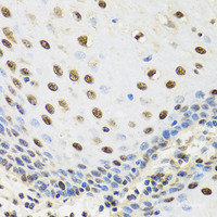 Immunohistochemistry of paraffin-embedded Human esophagus using TAF15 Polyclonal Antibody at dilution of 1:100 (40x lens) .