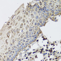 Immunohistochemistry of paraffin-embedded Human esophagus using GBF1 Polyclonal Antibody at dilution of 1:100 (40x lens) .
