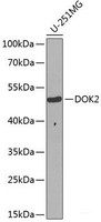 Western blot analysis of extracts of U-251MG cells using DOK2 Polyclonal Antibody at dilution of 1:1000.