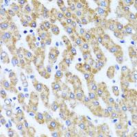 Immunohistochemistry of paraffin-embedded Human liver damage using INADL Polyclonal Antibody at dilution of 1:100 (40x lens) .