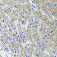 Immunohistochemistry of paraffin-embedded Human liver damage using SYNPO Polyclonal Antibody at dilution of 1:100 (40x lens) .