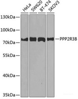Western blot analysis of extracts of various cell lines using PPP2R3B Polyclonal Antibody at dilution of 1:1000.