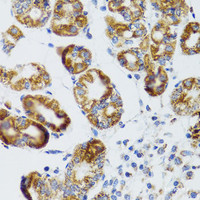 Immunohistochemistry of paraffin-embedded Human stomach using RIPK4 Polyclonal Antibody at dilution of 1:100 (40x lens) .