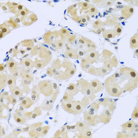 Immunohistochemistry of paraffin-embedded Human stomach using SMEK1 Polyclonal Antibody at dilution of 1:100 (40x lens) .