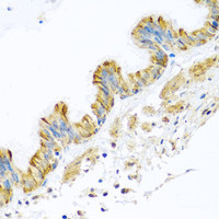 Immunohistochemistry of paraffin-embedded Human trachea using PCDHA12 Polyclonal Antibody at dilution of 1:100 (40x lens) .