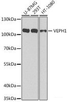 Western blot analysis of extracts of various cell lines using VEPH1 Polyclonal Antibody at dilution of 1:1000.