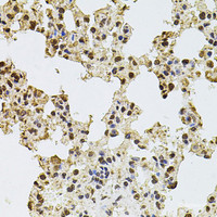 Immunohistochemistry of paraffin-embedded Rat lung using ZNF408 Polyclonal Antibody at dilution of 1:100 (40x lens) .
