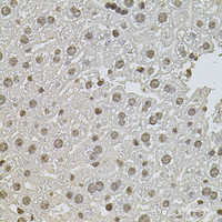 Immunohistochemistry of paraffin-embedded Mouse liver using ZNF408 Polyclonal Antibody at dilution of 1:100 (40x lens) .