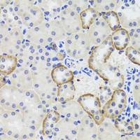 Immunohistochemistry of paraffin-embedded Mouse kidney using MTERFD3 Polyclonal Antibody at dilution of 1:100 (40x lens) .