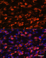 Immunofluorescence analysis of C6 cells using PIK3C2A Polyclonal Antibody at dilution of 1:100. Blue: DAPI for nuclear staining.