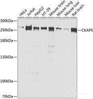 Western blot analysis of extracts of various cell lines using CKAP5 Polyclonal Antibody at dilution of 1:1000.