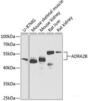 Western blot analysis of extracts of various cell lines using ADRA2B Polyclonal Antibody at dilution of 1:1000.