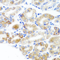 Immunohistochemistry of paraffin-embedded Human stomach using DLG1 Polyclonal Antibody at dilution of 1:100 (40x lens) .