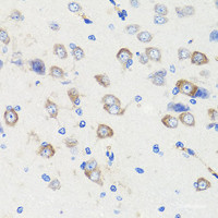 Immunohistochemistry of paraffin-embedded Rat brain using DLG1 Polyclonal Antibody at dilution of 1:100 (40x lens) .