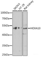 Western blot analysis of extracts of various cell lines using HOXA10 Polyclonal Antibody at dilution of 1:1000.