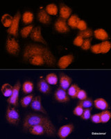 Immunofluorescence analysis of OVCAR-3 cells using MSH4 Polyclonal Antibody at dilution of 1:100 (40x lens) . Blue: DAPI for nuclear staining.