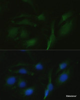 Immunofluorescence analysis of U2OS cells using TRPV1 Polyclonal Antibody at dilution of 1:100. Blue: DAPI for nuclear staining.