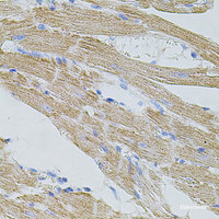 Immunohistochemistry of paraffin-embedded Mouse heart using TRPA1 Polyclonal Antibody at dilution of 1:100 (40x lens) .