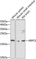 Western blot analysis of extracts of various cell lines using ARPC5 Polyclonal Antibody at dilution of 1:1000.