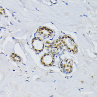 Immunohistochemistry of paraffin-embedded Human breast using BCCIP Polyclonal Antibody at dilution of 1:100 (40x lens) .