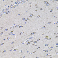 Immunohistochemistry of paraffin-embedded Rat brain using TMC1 Polyclonal Antibody at dilution of 1:100 (40x lens) .