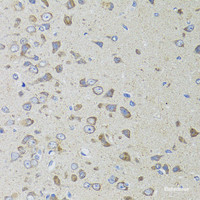 Immunohistochemistry of paraffin-embedded Rat brain using AIFM3 Polyclonal Antibody at dilution of 1:100 (40x lens) .