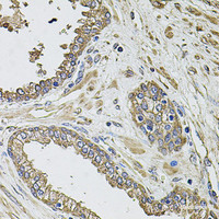 Immunohistochemistry of paraffin-embedded Human prostate using KCNK9 Polyclonal Antibody at dilution of 1:100 (40x lens) .