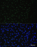 Immunofluorescence analysis of C6 cells using DDX50 Polyclonal Antibody at dilution of 1:100. Blue: DAPI for nuclear staining.