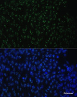 Immunofluorescence analysis of NIH-3T3 cells using DDX50 Polyclonal Antibody at dilution of 1:100. Blue: DAPI for nuclear staining.