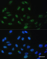 Immunofluorescence analysis of U-2 OS cells using DDX50 Polyclonal Antibody at dilution of 1:100. Blue: DAPI for nuclear staining.