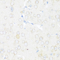 Immunohistochemistry of paraffin-embedded Rat brain using EIF3J Polyclonal Antibody at dilution of 1:100 (40x lens) .
