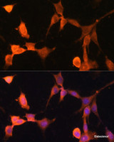 Immunofluorescence analysis of NIH-3T3 cells using CACYBP Polyclonal Antibody at dilution of 1:100. Blue: DAPI for nuclear staining.