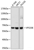 Western blot analysis of extracts of various cell lines using VPS33B Polyclonal Antibody at dilution of 1:1000.