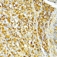 Immunohistochemistry of paraffin-embedded Rat ovary using VAMP1 Polyclonal Antibody at dilution of 1:100 (40x lens) .