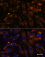 Immunofluorescence analysis of U-2 OS cells using SUCLG2 Polyclonal Antibody at dilution of 1:100 (40x lens) . Blue: DAPI for nuclear staining.