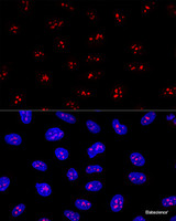 Confocal immunofluorescence analysis of U2OS cells using EBNA1BP2 Polyclonal Antibody at dilution of 1:200. Blue: DAPI for nuclear staining.