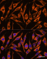 Immunofluorescence analysis of L929 cells using SNX15 Polyclonal Antibody at dilution of 1:100. Blue: DAPI for nuclear staining.