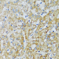 Immunohistochemistry of paraffin-embedded Human liver using C1QC Polyclonal Antibody at dilution of 1:100 (40x lens) .