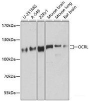 Western blot analysis of extracts of various cell lines using OCRL Polyclonal Antibody at dilution of 1:1000.
