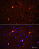 Immunofluorescence analysis of Rat brain using CORO1A Polyclonal Antibody at dilution of 1:100 (40x lens) . Blue: DAPI for nuclear staining.