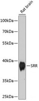 Western blot analysis of extracts of Rat brain using SRR Polyclonal Antibody at dilution of 1:1000.