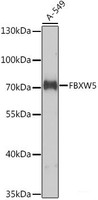 Western blot analysis of extracts of A-549 cells using FBXW5 Polyclonal Antibody at dilution of 1:1000.