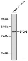 Western blot analysis of extracts of Human testis using SYCP3 Polyclonal Antibody.